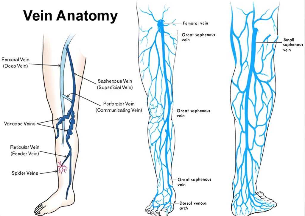 Vein Procedures