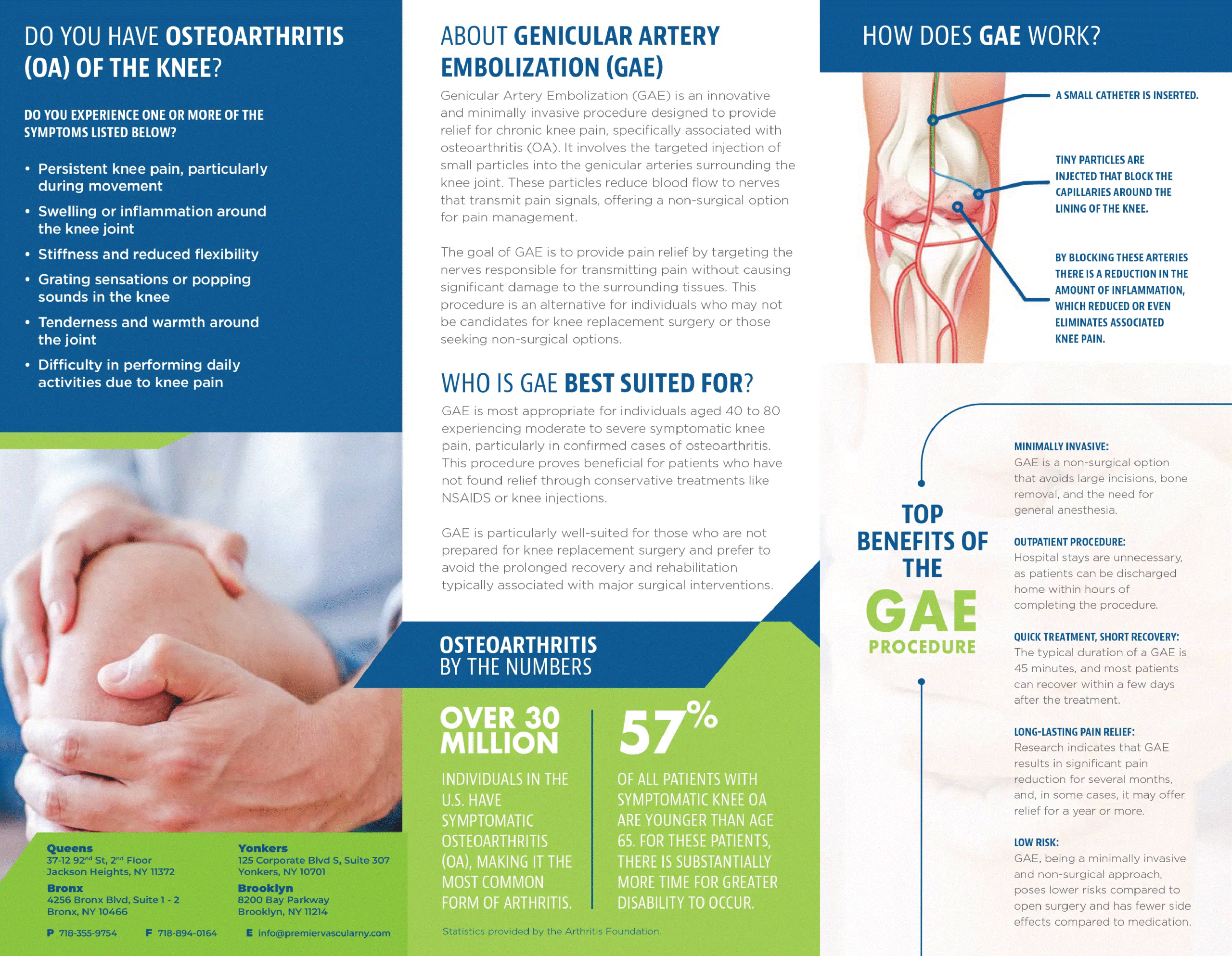 Genicular Artery Embolization Part 2